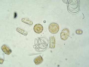 Light Microscope Image of Diatoms